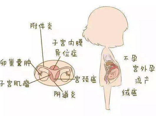 阴道分泌物91短视频免费下载分析阴道炎早期症状