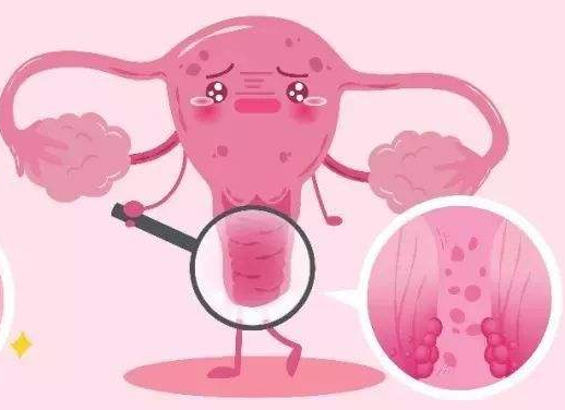 白带常规91短视频在线观看经典下载厂家提醒女士做好私密处清洗