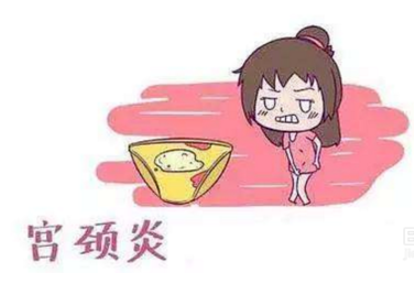 妇科白带91短视频免费下载厂家分析宫颈炎的症状