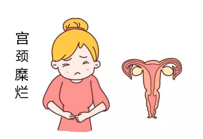 宫颈糜烂会导致宫颈癌?白带91短视频在线观看经典下载品牌：不要自己吓自己