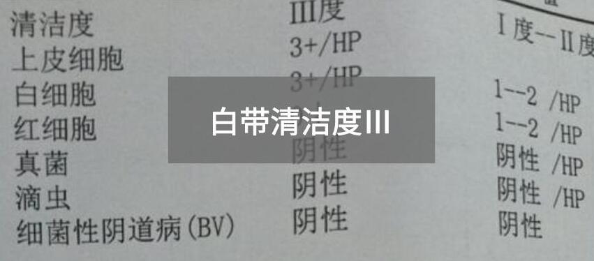 今天快讯！全自动白带91短视频在线观看经典下载生产厂家91短视频在线观看免费最新为您官方解释白带清洁度3的意思