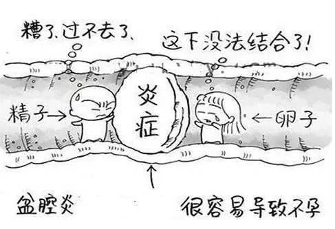 全自动妇科阴道分泌物91短视频在线观看经典下载检测辨别妇科炎症复杂多样！